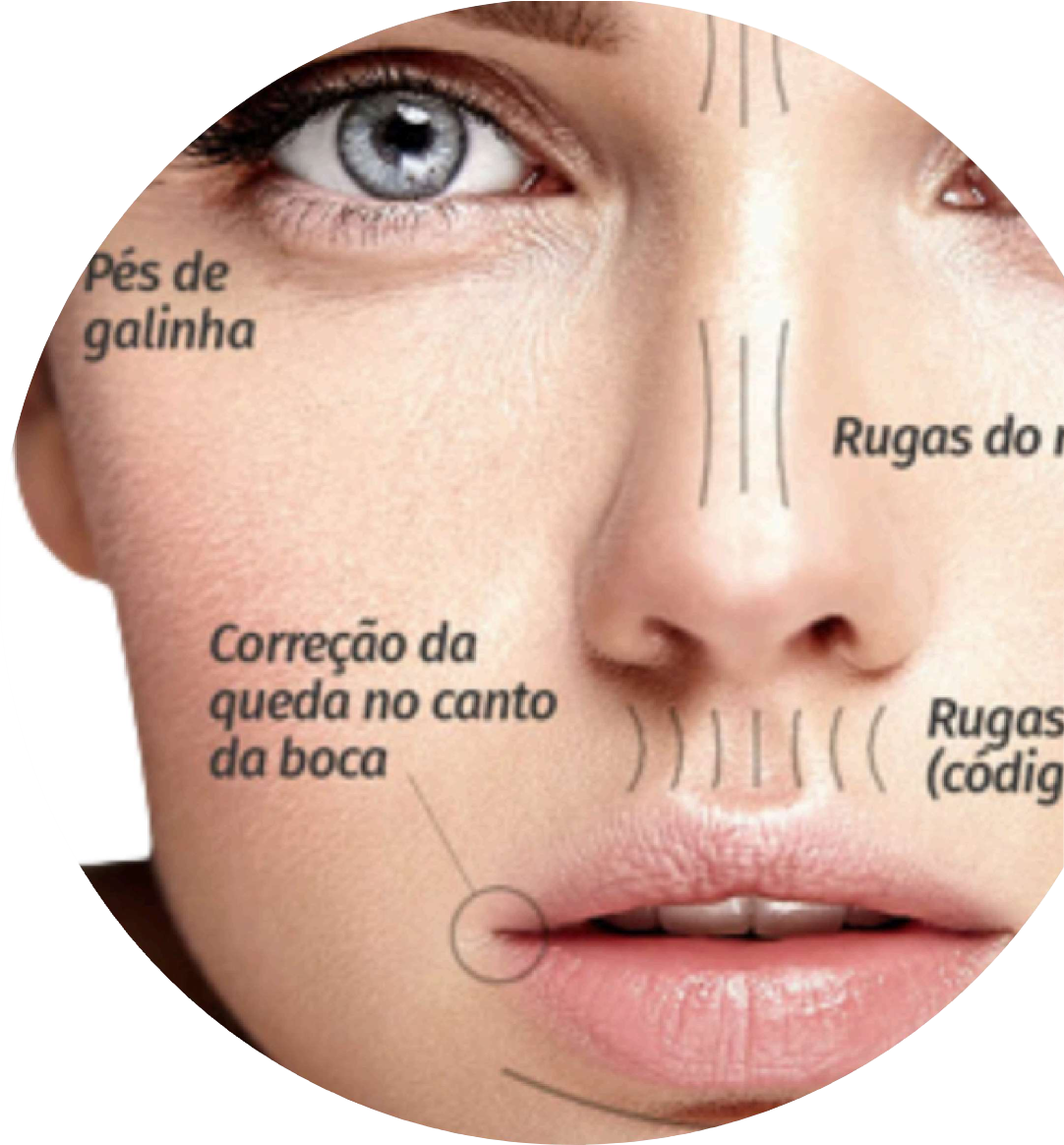 Harmonização Facial na Anand Clínica - mapeamento de áreas de tratamento